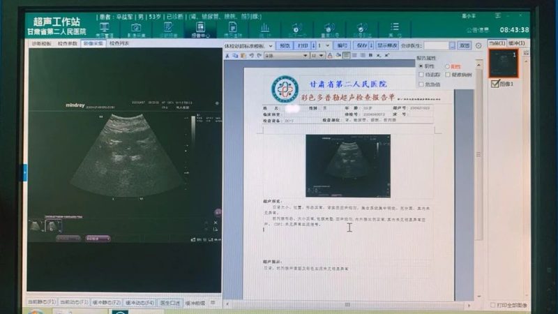 体检报告图片先看这几处
